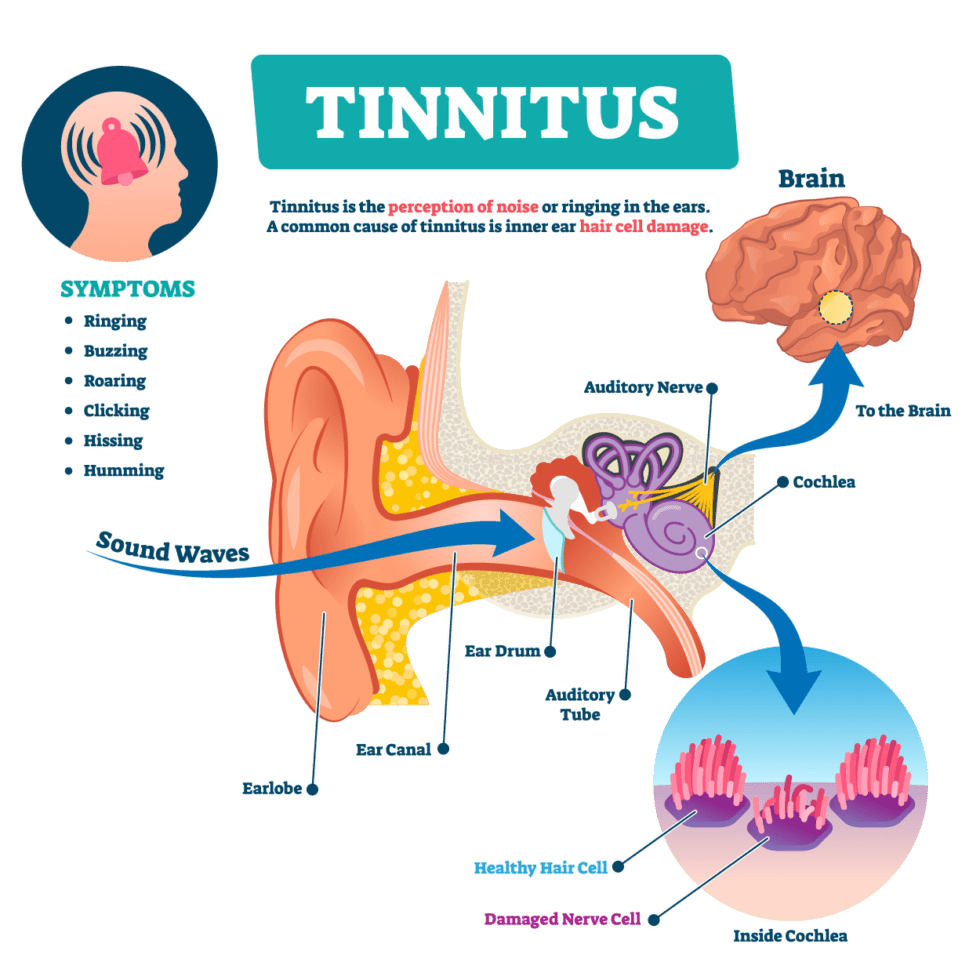 Why Do I Have Tinnitus In The Morning