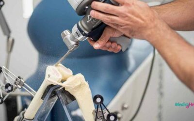 Robotgeassisteerde knie operatie – MAKO systeem